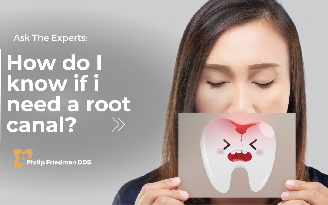 How do I know if I need a root canal?